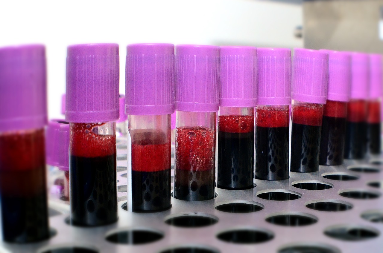 blood-3996485_1280