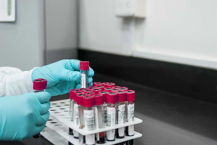 lab-experiment-test-chemistry