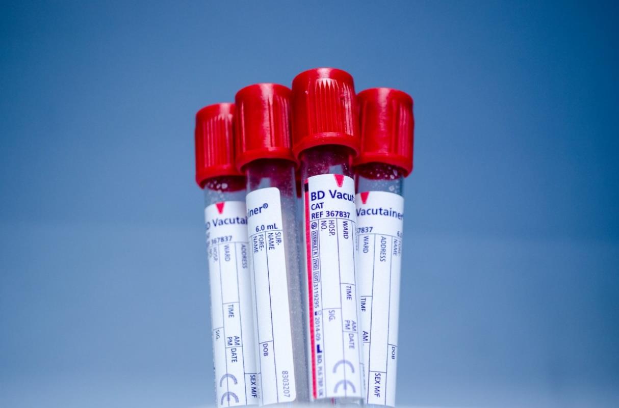 blood sample