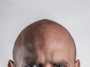 Calling a man ‘bald’ isn’t sexual harassment