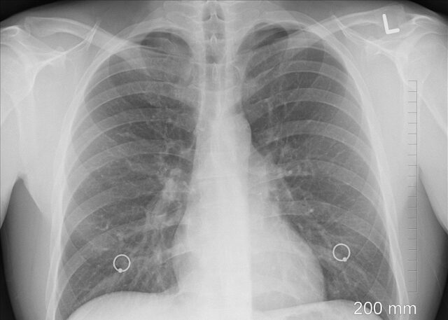 diagnosis-xray