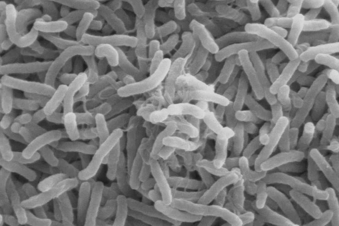 Cholera_bacteria_SEM
