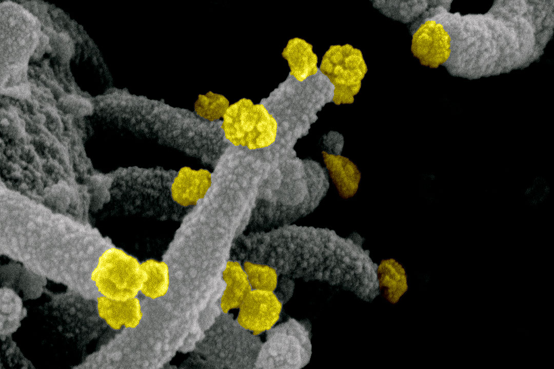 Novel_Coronavirus_SARS-CoV-2