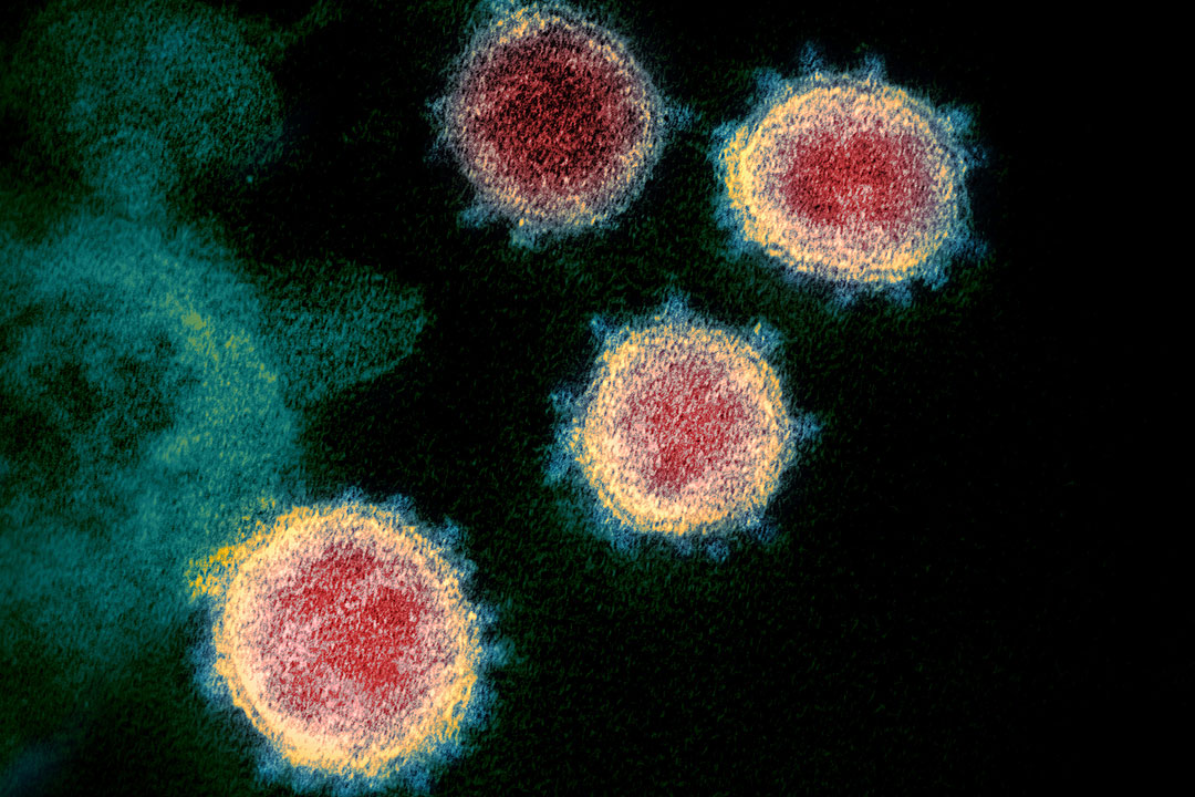 Novel_Coronavirus_SARS-CoV-2