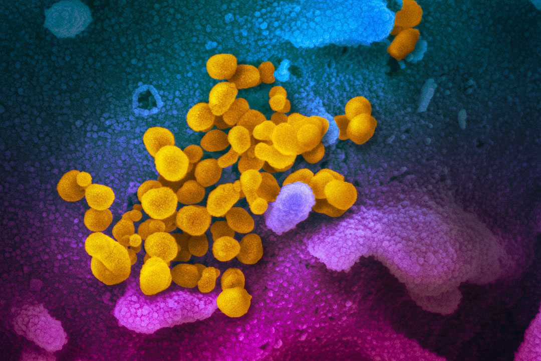 SARS-CoV-2_(yellow)