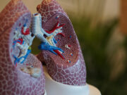 Lung cancer found among non‑smokers; experts urge regular screening