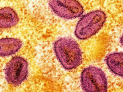 Senator pushes stricter health measures in schools vs mpox