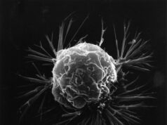 Biopsy won’t spread cancer, says medical expert