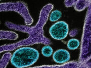 Pakistan becomes latest Asian country to introduce checks for deadly Nipah virus