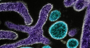 Pakistan becomes latest Asian country to introduce checks for deadly Nipah virus