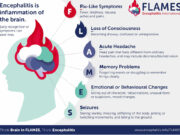 Encephalitis can look like common illness; experts urge public to learn “FLAMES”