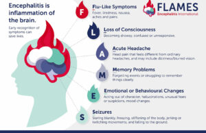 Encephalitis can look like common illness; experts urge public to learn “FLAMES”