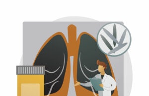 Ending TB requires a whole-of-society approach