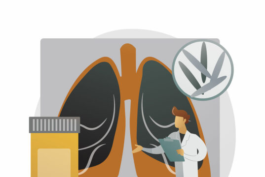 Ending TB requires a whole-of-society approach