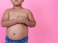 Stemming the obesity epidemic among Filipino children