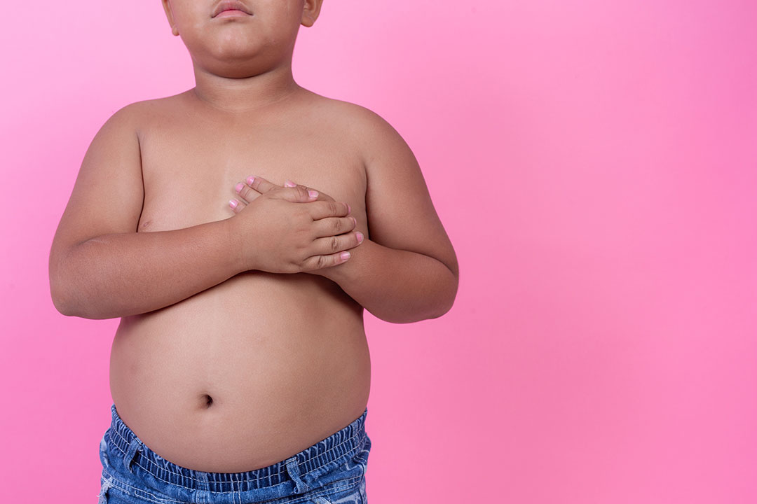 Stemming the obesity epidemic among Filipino children