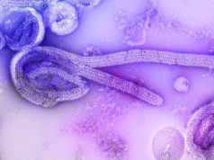 Health workers race to contain Congo’s fast-spreading Ebola outbreak